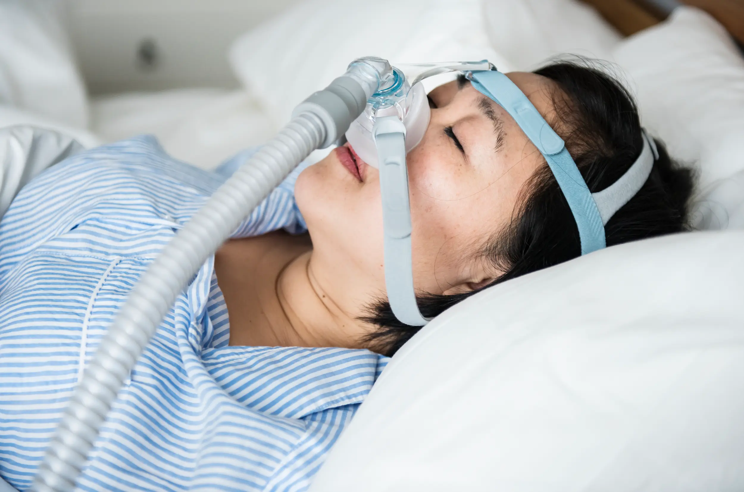 Apnea del sueño